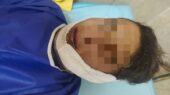 شوخی خطرناک نوجوانان در چناران به حادثه سوختگی منجر شد