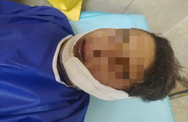 شوخی خطرناک نوجوانان در چناران به حادثه سوختگی منجر شد