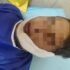 شوخی خطرناک نوجوانان در چناران به حادثه سوختگی منجر شد